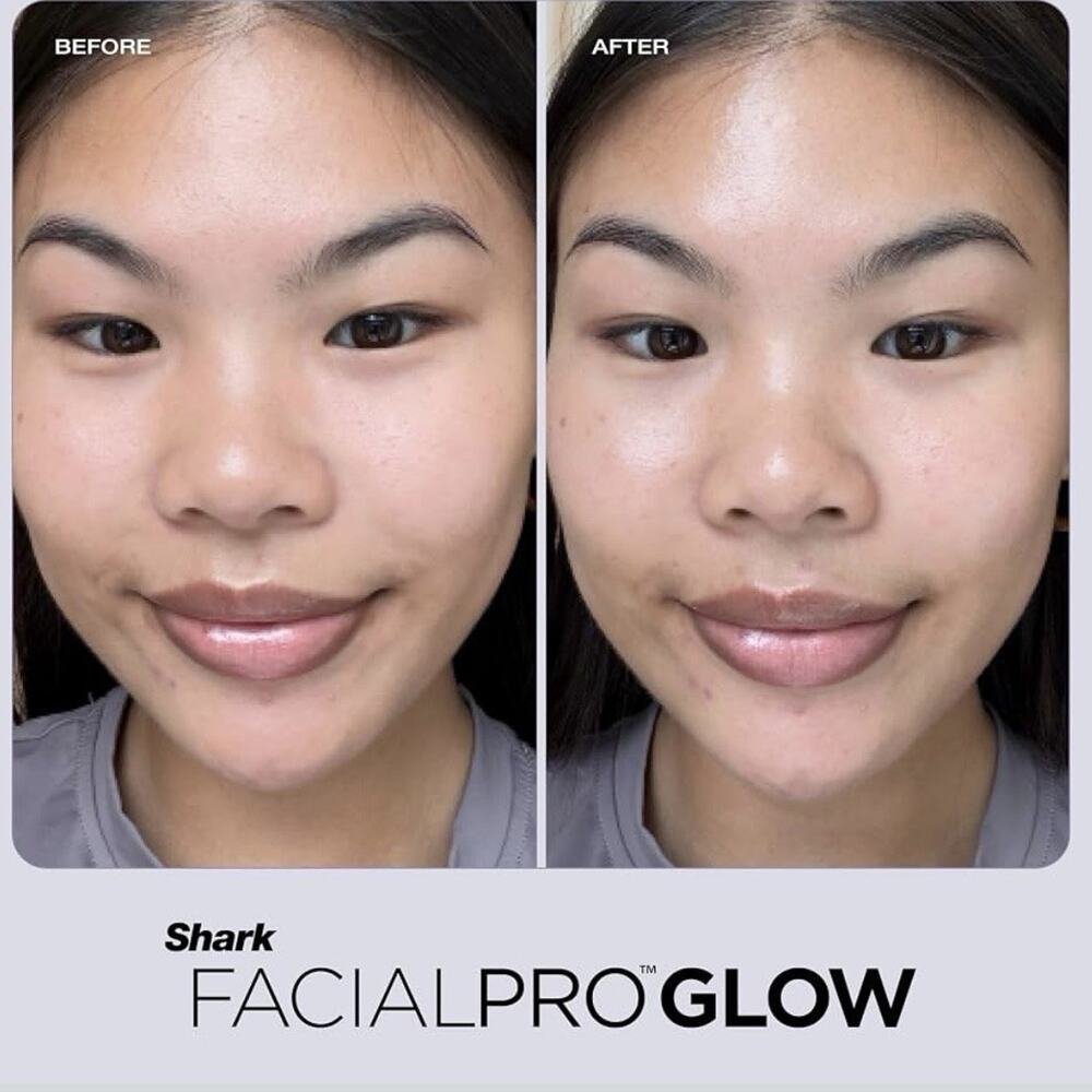 Shark FacialPro Glow at Home Hydro Powered Facial System FH320PL Open Box - Picture 15 of 16